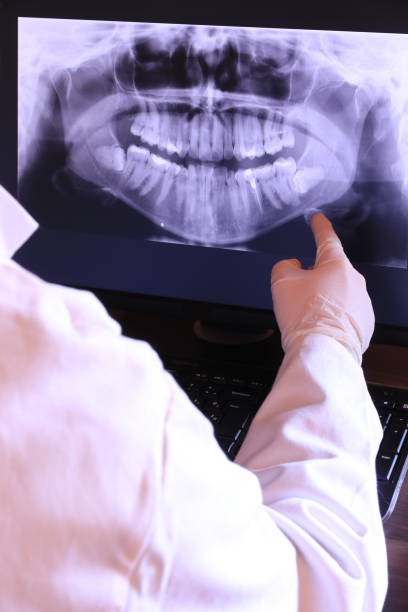 Best Emergency Root Canal Treatment in Beltsville, MD